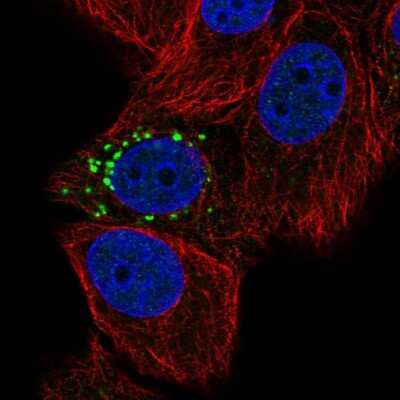 Immunocytochemistry/ Immunofluorescence: PPM1J Antibody [NBP2-13797]