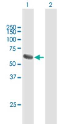 Western Blot: PPM1J Antibody [H00333926-B01P]