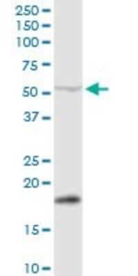 Western Blot: PPM1J Antibody [H00333926-D01P]