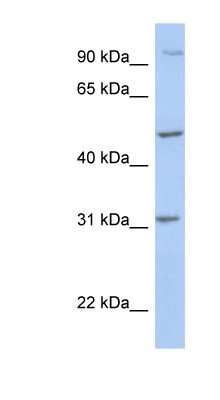 Western Blot: PPM1J Antibody [NBP1-56765]