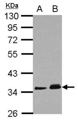 Western Blot: PPM1J Antibody [NBP2-19902]