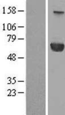 Western Blot: PPM1J Overexpression Lysate [NBL1-14664]