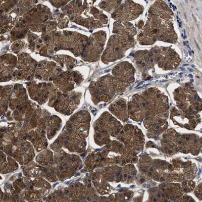 Immunohistochemistry-Paraffin: PPM1K Antibody [NBP1-85037]