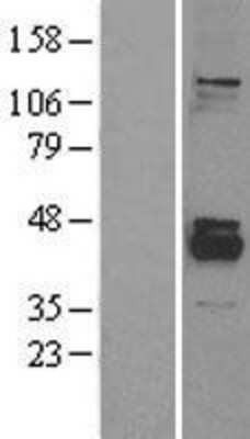 Western Blot: PPM1K Overexpression Lysate [NBL1-14665]