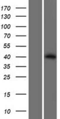 Western Blot: PP2C epsilon/PPM1L Overexpression Lysate [NBL1-14666]