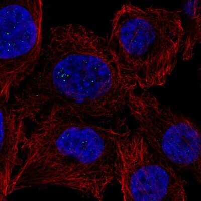 Immunocytochemistry/ Immunofluorescence: PPM1M Antibody [NBP2-56555]