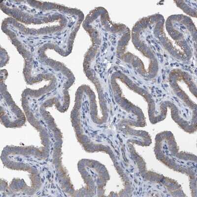 Immunohistochemistry-Paraffin: PPM1M Antibody [NBP1-83534]