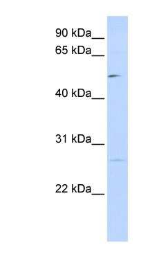 Western Blot: PPM1M Antibody [NBP1-56635]