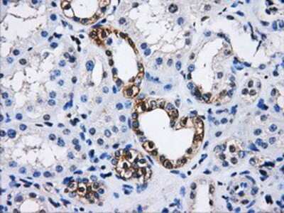 Immunohistochemistry-Paraffin: PPME1 Antibody (OTI7F12) [NBP2-02240]