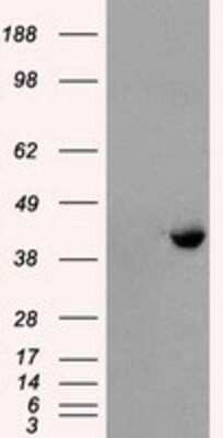 Western Blot: PPME1 Antibody (OTI7F12) [NBP2-02240]