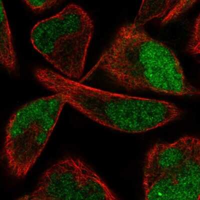 Immunocytochemistry/ Immunofluorescence: PPME1 Antibody [NBP2-57103]