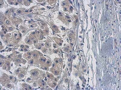 Immunohistochemistry-Paraffin: PPME1 Antibody [NBP2-19903]