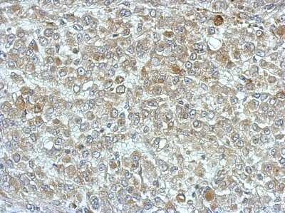Immunohistochemistry-Paraffin: PPME1 Antibody [NBP2-19904]