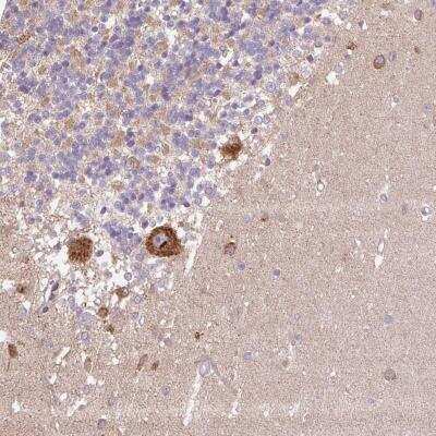 Immunohistochemistry-Paraffin: PPME1 Antibody [NBP2-38515]