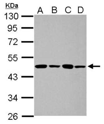 Western Blot: PPME1 Antibody [NBP2-19903]
