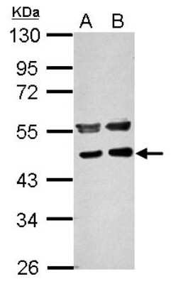 Western Blot: PPME1 Antibody [NBP2-19903]