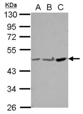 Western Blot: PPME1 Antibody [NBP2-19904]