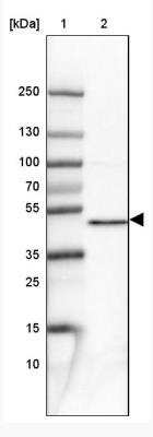 Western Blot: PPME1 Antibody [NBP2-38515]