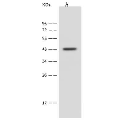 Western Blot: PPME1 Antibody [NBP2-99601]