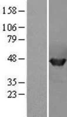 Western Blot: PPME1 Overexpression Lysate [NBL1-14668]