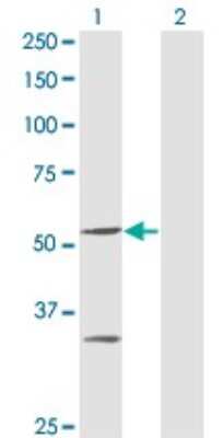 Western Blot: PPOX Antibody (2B5) [H00005498-M04]