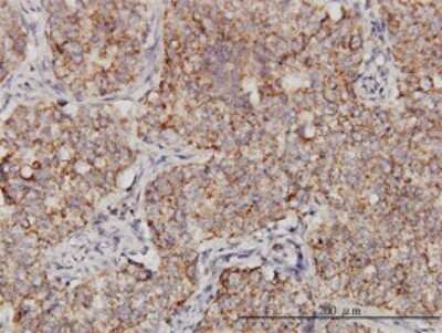 Immunohistochemistry-Paraffin: PPOX Antibody (2F10) [H00005498-M01]