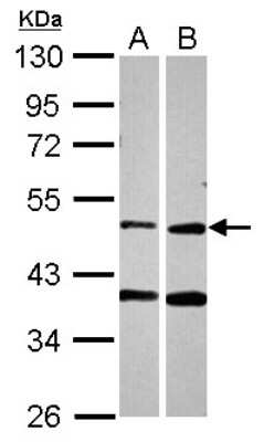 Western Blot: PPOX Antibody [NBP2-19905]