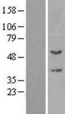 Western Blot: PPOX Overexpression Lysate [NBL1-14669]