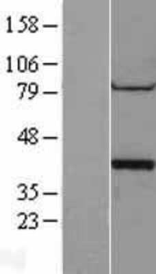 Western Blot: PP1 alpha/PPP1A Overexpression Lysate [NBL1-14670]