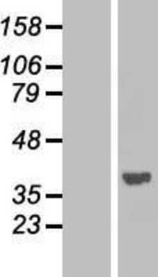 Western Blot: PP1 alpha/PPP1A Overexpression Lysate [NBP2-10998]