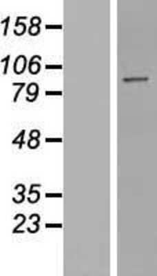 Western Blot: PNUTS/PPP1R10 Overexpression Lysate [NBP2-08077]