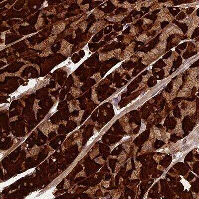 Immunohistochemistry-Paraffin: PPP1R11 Antibody [NBP2-13798]