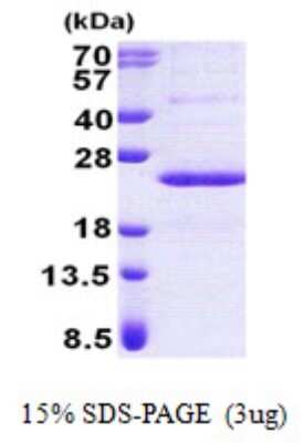 SDS-PAGE: Recombinant Human PPP1R11 His Protein [NBP2-23379]