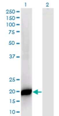 Western Blot: PPP1R14B Antibody (4G2) [H00026472-M07]