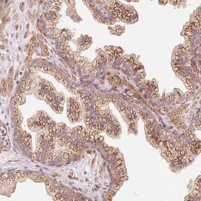 Immunohistochemistry-Paraffin: PPP1R14B Antibody [NBP2-31569]