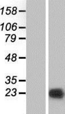 Western Blot: PPP1R14B Overexpression Lysate [NBP2-05637]