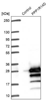 Western Blot: PPP1R14D/GBPI-1 Antibody [NBP1-85484]