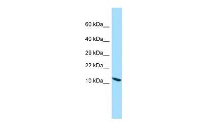 Western Blot: PPP1R14D/GBPI-1 Antibody [NBP2-83412]