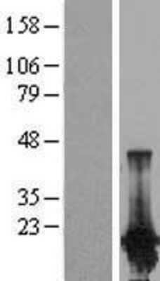 Western Blot: PPP1R14D/GBPI-1 Overexpression Lysate [NBP2-06935]