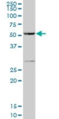 Western Blot: PPP1R16A Antibody [H00084988-B01P]