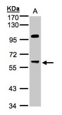 Western Blot: PPP1R16A Antibody [NBP1-32480]