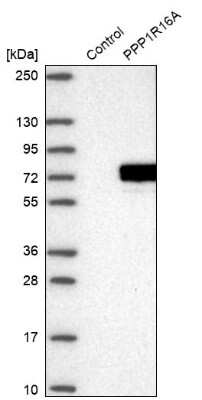 Western Blot: PPP1R16A Antibody [NBP1-82750]