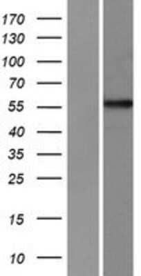 Western Blot: PPP1R16A Overexpression Lysate [NBP2-05954]