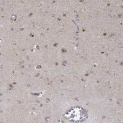 Immunohistochemistry-Paraffin: PPP1R16B Antibody [NBP3-17296]