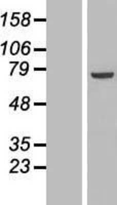 Western Blot: PPP1R16B Overexpression Lysate [NBL1-14677]