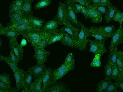 Immunocytochemistry/ Immunofluorescence: PPP1R18 Antibody [NBP2-97370]