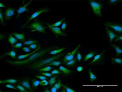 Immunocytochemistry/ Immunofluorescence: PPP1R1C Antibody [H00151242-D01P]