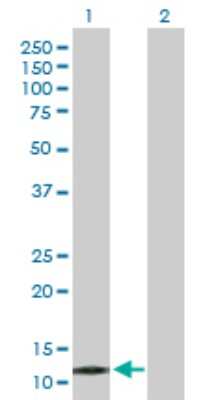 Western Blot: PPP1R1C Antibody [H00151242-D01P]