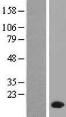 Western Blot: PPP1R1C Overexpression Lysate [NBL1-14681]