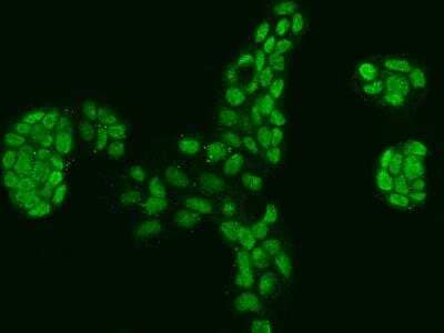 Immunocytochemistry/ Immunofluorescence: PPP1R26 Antibody [NBP3-06098]